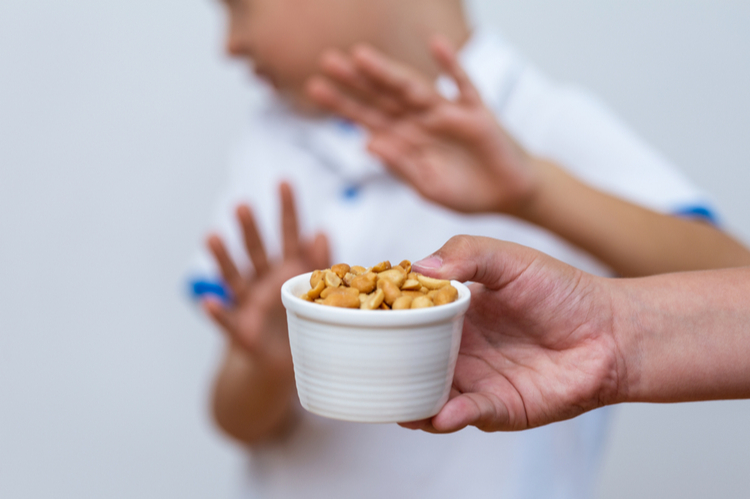 Peanut food allergy